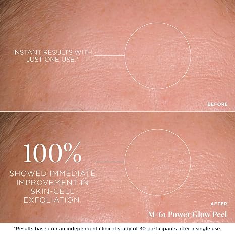m-61 PowerGlow Peel, 30 Treatments