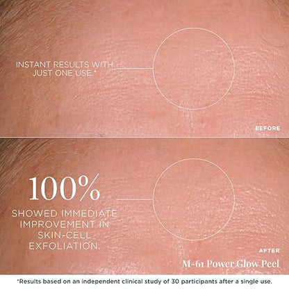 m-61 PowerGlow Peel, 30 Treatments